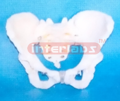 ADULT FEMALE HUMAN PELVIS